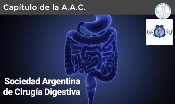 SACD